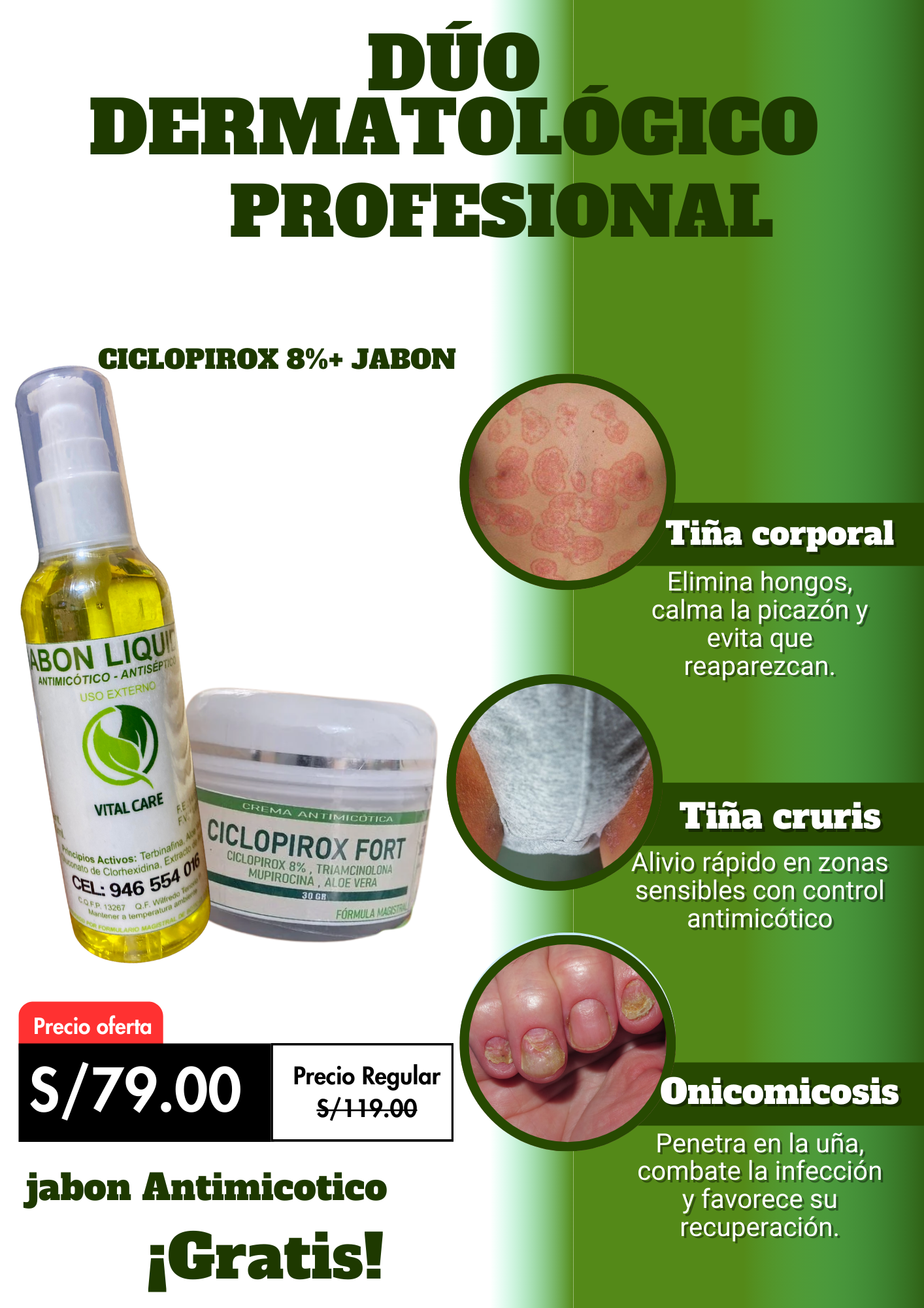 Ciclopirox Fort 8% + JABON ANTIMICOTICO