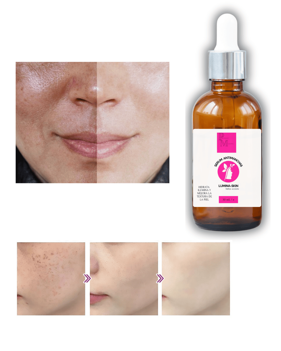 SERUM ANTIMANCHAS LUMINA-SKIN CON NIACINAMIDA 30ML