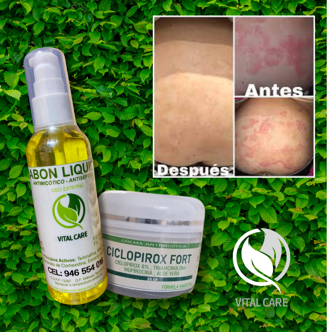 Ciclopirox Fort 8% + JABON ANTIMICOTICO